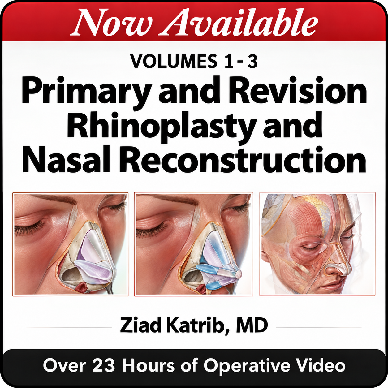 Primary and Revision Rhinoplasty and Nasal Reconstruction, Volumes 1-3 2026